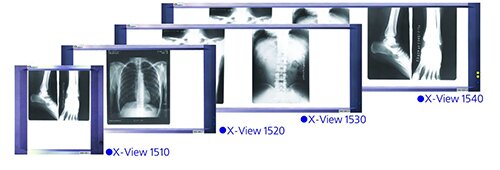 Негатоскопы Dixion X-View LED